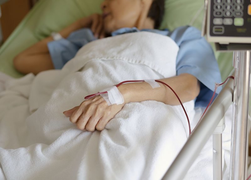 Waspada Stroke: Deteksi Dini Selamatkan Nyawa