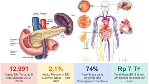 Kajian Ekonomi Penyakit Diabetes Mellitus di Kota Manado Sulawesi Utara