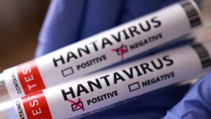 Hanta Virus Mengintai, Kenali Gejala dan Langkah Pencegahan